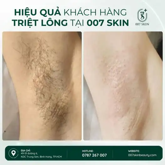ÁO HAI DÂY, ÁO SÁT NÁCH – CỨ TỰ TIN DIỆN! ✨