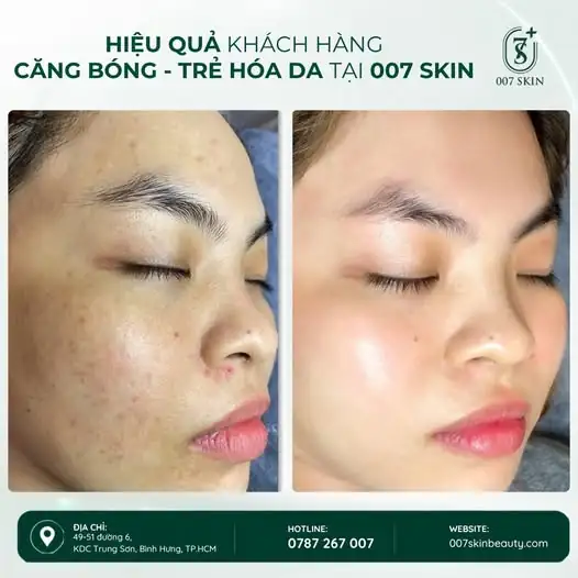 CĂNG BÓNG – TRẺ HÓA DA | LÀN DA ĐẸP LÊN TỪNG NGÀY ✨