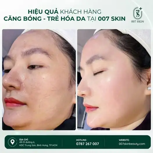 CHỊ EM ĐANG MÊ GÌ? — LÀN DA CĂNG MƯỚT, TRẺ TRUNG CHỨ GÌ!