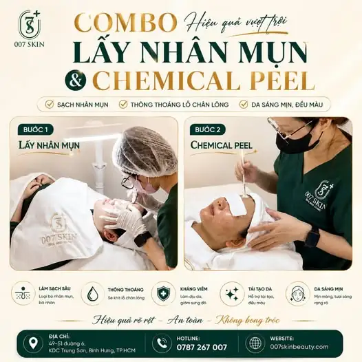 COMBO ƯU VIỆT: SẠCH MỤN - MỜ THÂM - DA SÁNG MỊN KHÔNG BONG TRÓC! ✨