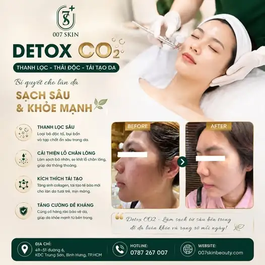 DA BÍ BÁCH, LỖ CHÂN LÔNG TO? ĐẾN 007 SKIN DETOX CO2 NGAY! 🌪️