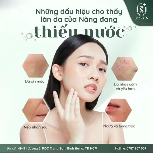 DA "KÊU CỨU" VÌ THIẾU NƯỚC - NÀNG ĐÃ BIẾT CHƯA? 💧🆘