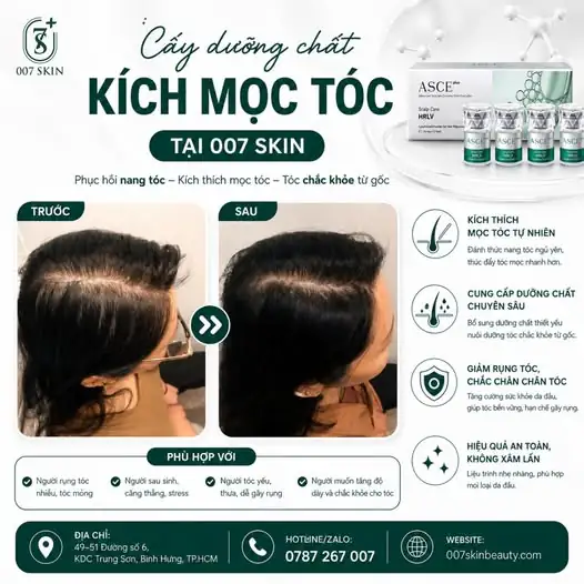 ĐÁNH THỨC NANG TÓC – TÁI SINH TỪ GỐC CÙNG EXOSOME ASCE+ HRLV! 🌟