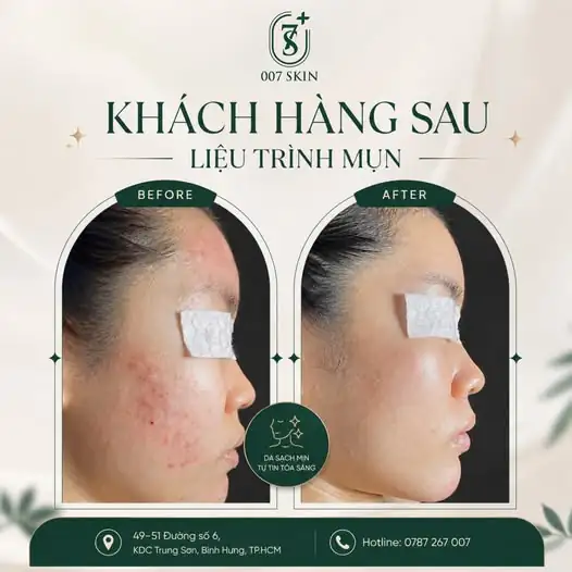 ĐẸP HƠN MỖI NGÀY – TỰ TIN TỎA SÁNG 🌿