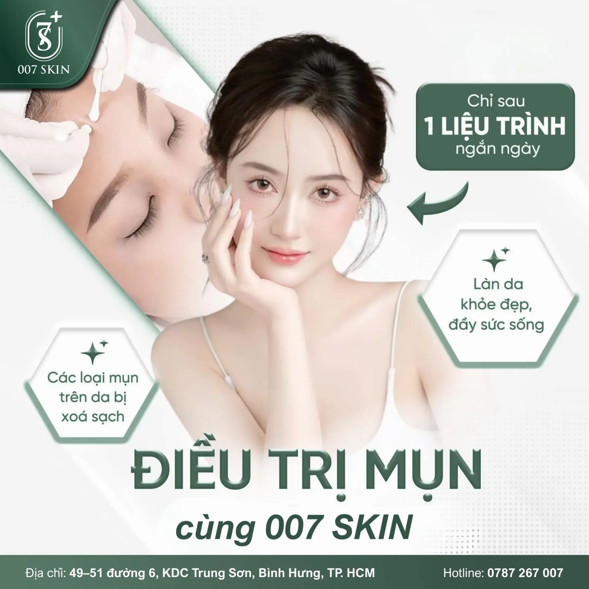 ĐIỀU TRỊ MỤN CHUẨN DA – LẤY LẠI LÀN DA KHỎE ĐẸP CÙNG 007 SKIN
