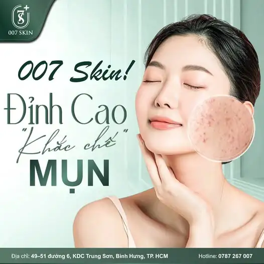 ĐỪNG ĐỂ MỤN LÀM RÀO CẢN SỰ TỰ TIN CỦA BẠN! 🥺