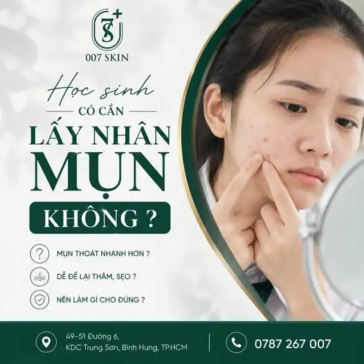 HỌC SINH CÓ NÊN ĐI LẤY NHÂN MỤN KHÔNG? 🤔