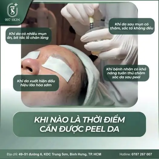 KHI NÀO LÀ "THỜI ĐIỂM VÀNG" ĐỂ PEEL DA? ⏳