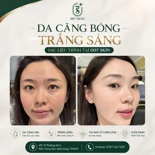 Làn da đẹp không chỉ là trắng sáng mà còn phải khỏe từ bên trong.