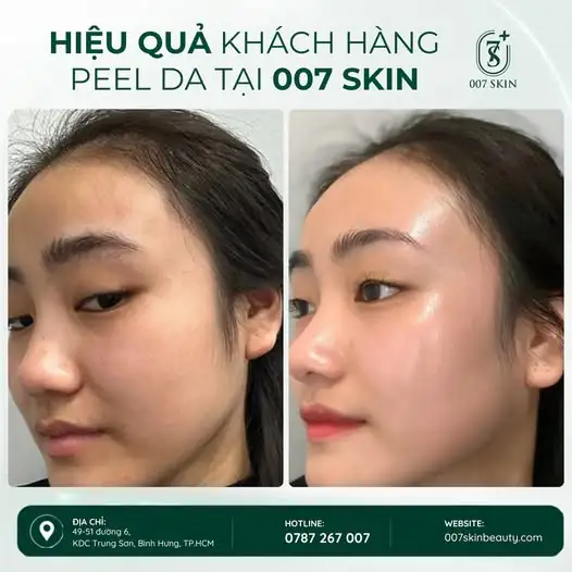 Làn da đẹp không phải là làn da không tì vết, mà là làn da được chăm sóc đúng cách và phù hợp.