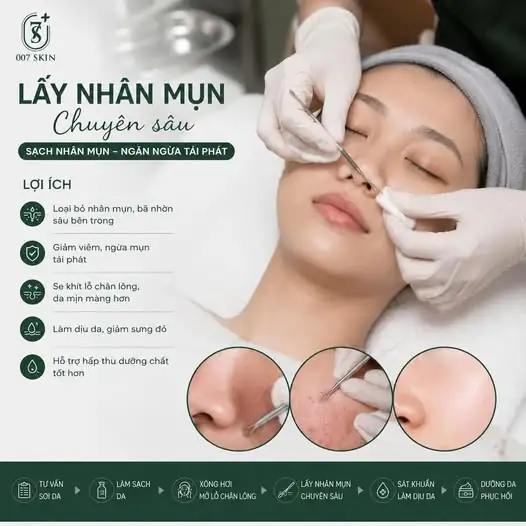 Làn da sần sùi, lỗ chân lông to luôn là nỗi ám ảnh của bạn? Mụn cứ đi rồi lại đến, để lại thâm sẹo khiến bạn mất tự tin?