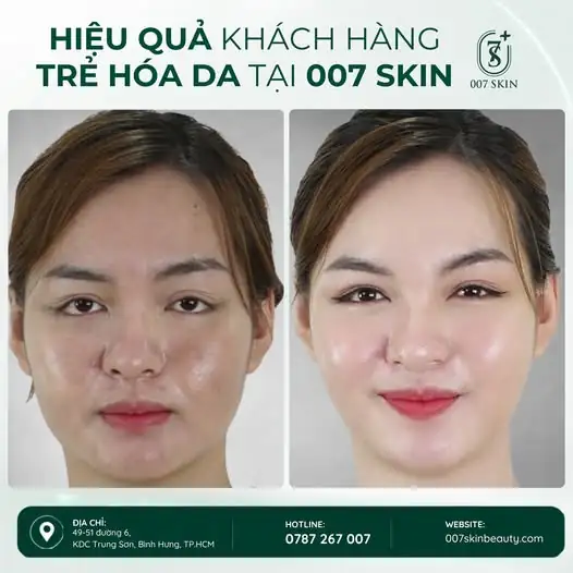 LÀN DA THAY ĐỔI – NHAN SẮC THĂNG HẠNG ✨