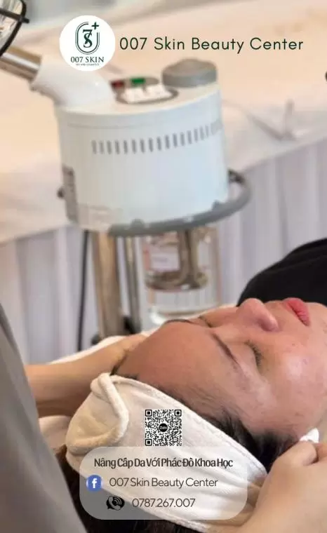 MESOTHERAPY LỖ CHÂN LÔNG TO, DA DẦU MỤN