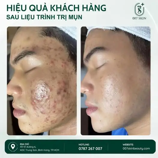 MỘT HÀNH TRÌNH – MỘT LÀN DA KHÁC BIỆT
