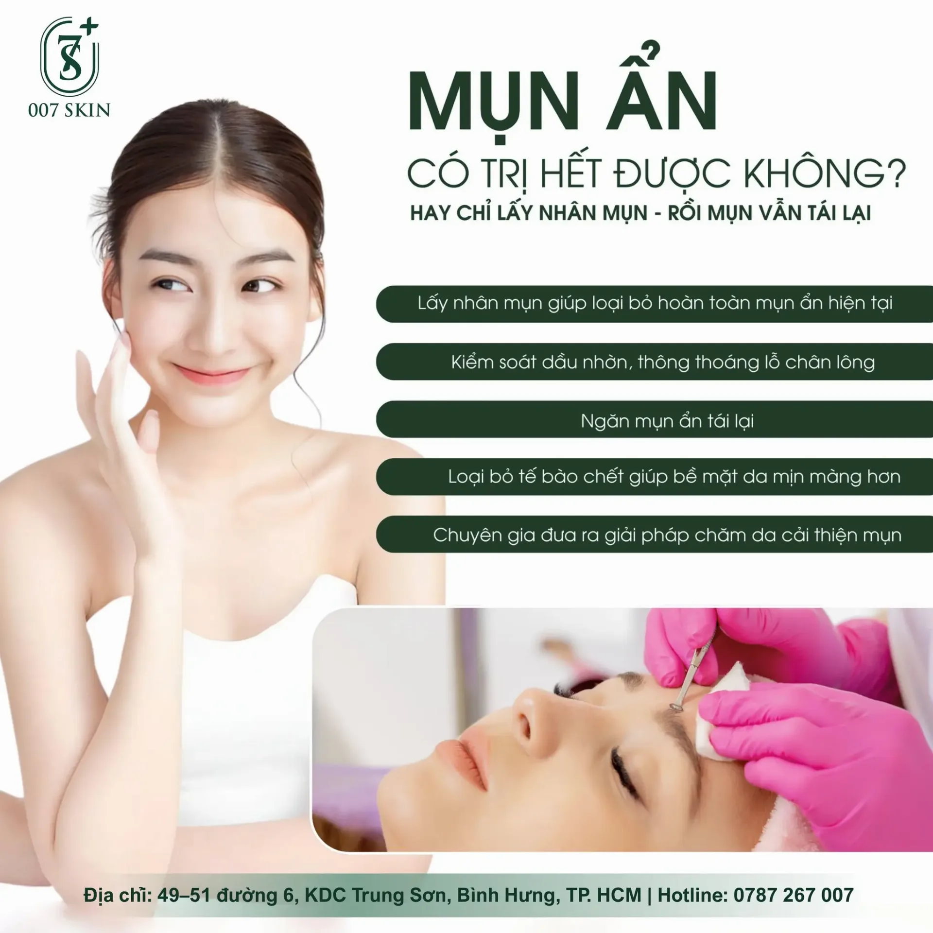 MỤN ẨN – CÓ TRỊ HẾT ĐƯỢC KHÔNG?