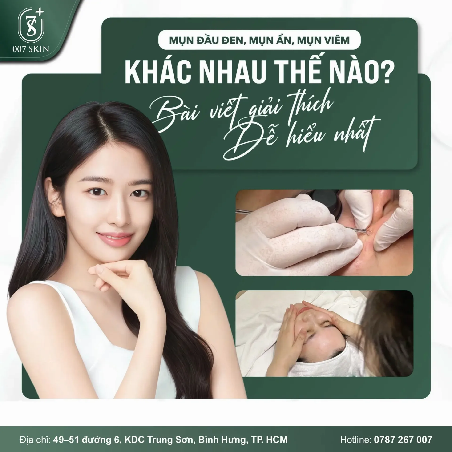 MỤN ĐẦU ĐEN, MỤN ẨN, MỤN VIÊM… KHÁC NHAU THẾ NÀO? – BÀI VIẾT GIẢI THÍCH DỄ HIỂU NHẤT