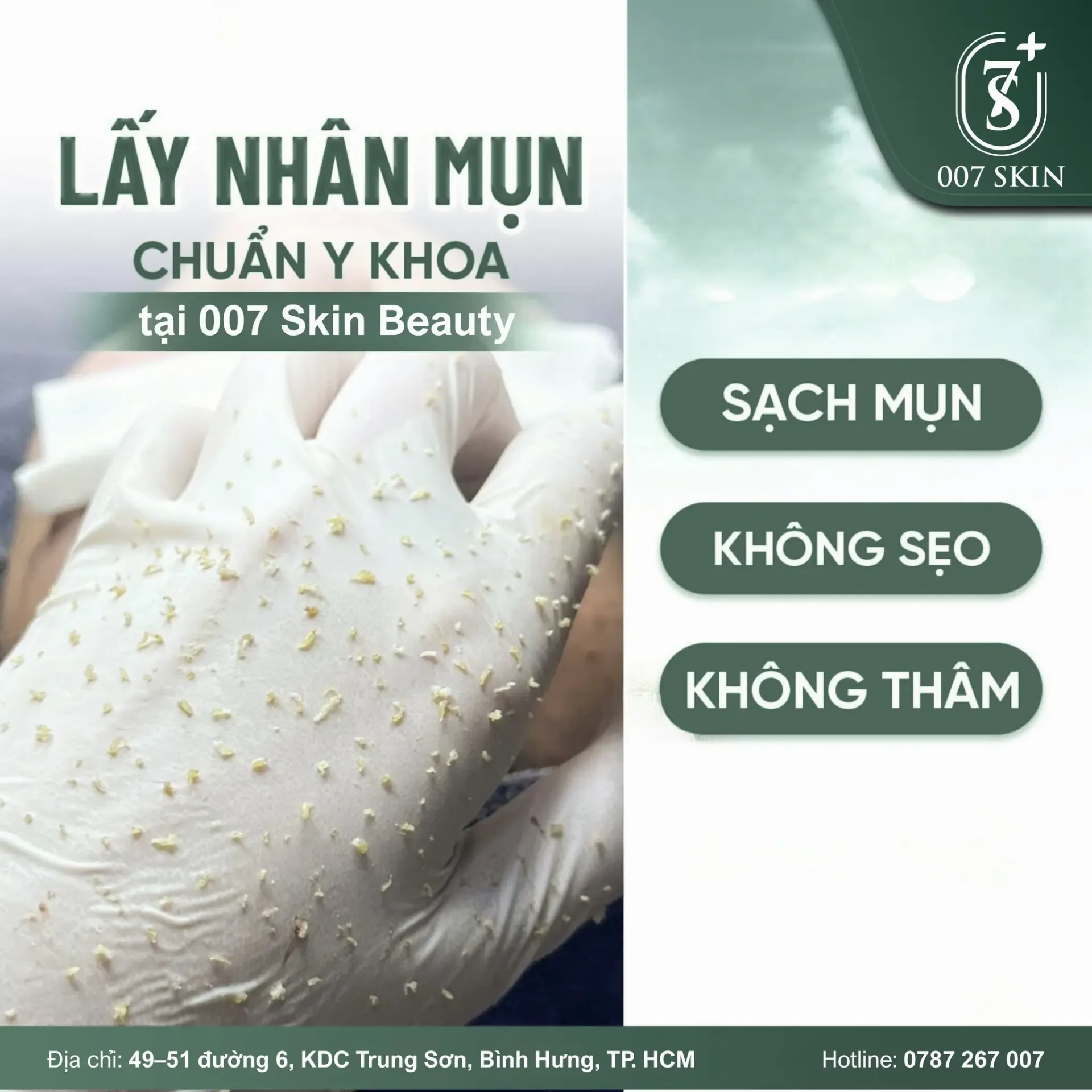 Mụn không đáng sợ – lấy mụn sai cách mới đáng lo ❌