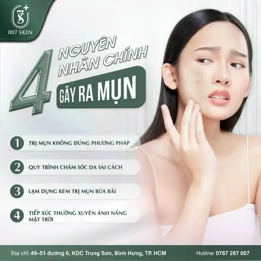 MỤN MÃI KHÔNG HẾT – CÓ PHẢI BẠN ĐANG "NGƯỢC ĐÃI" LÀN DA? 😰