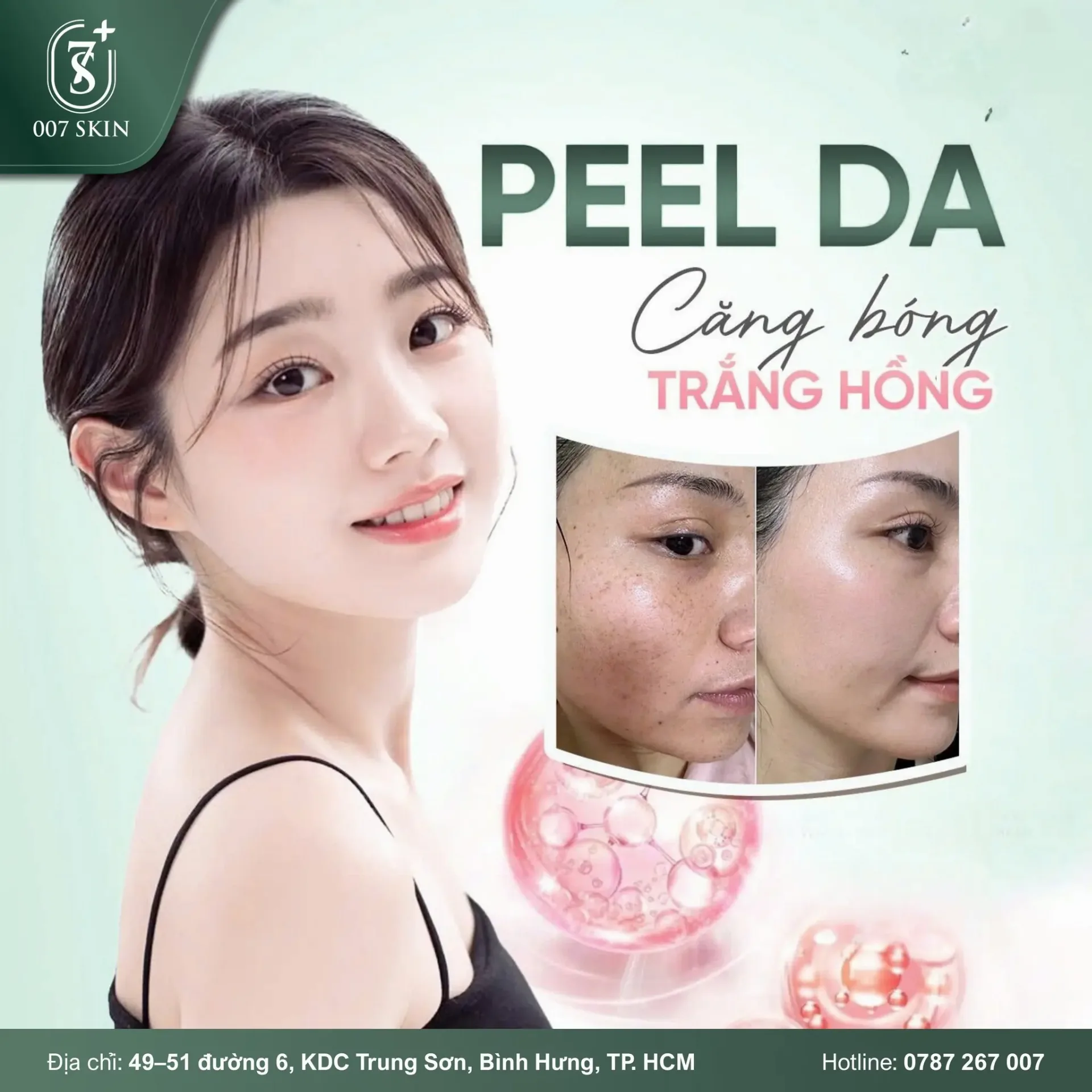 PEEL DA – BÍ QUYẾT LÀN DA CĂNG BÓNG, TRẮNG HỒNG TỰ NHIÊN