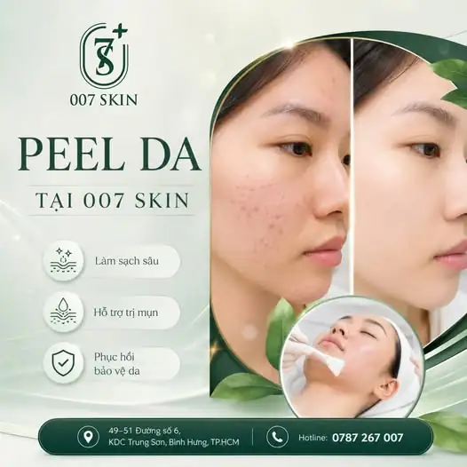 PEEL DA SIÊU CẤP - TẠI SAO CHƯA THỬ? 🔥