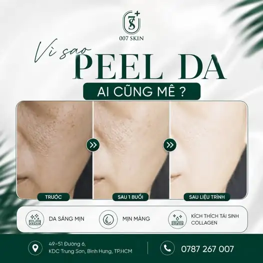 PEEL DA TẠI 007 SKIN - ĐÁNH THỨC VẺ ĐẸP ✨