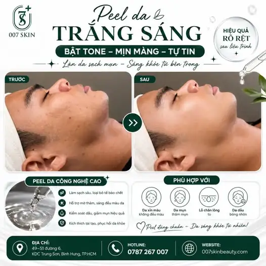 PEEL DA TRẮNG SÁNG – BẬT TONE, MỊN MÀNG, TỰ TIN 🔹