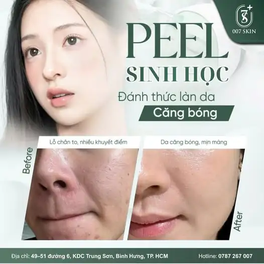 PEEL SINH HỌC – ĐÁNH THỨC LÀN DA CĂNG BÓNG MỊN MÀNG 💎