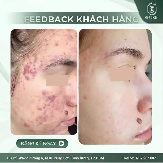 SỰ THẬT ĐẰNG SAU MÀN "L.ỘT X.ÁC" NGOẠN MỤC!