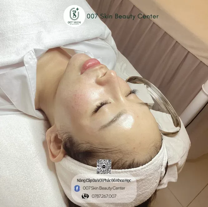 Tại Sao Da Dầu Dễ Lên Mụn Hơn? – Bí Quyết Điều Trị Hiệu Quả Tại 007 Skin Beauty
