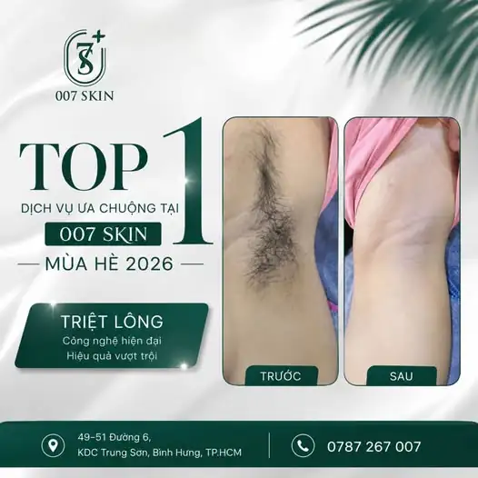 TẠI SAO TRIỆT LÔNG 007 SKIN LÀ "TOP 1 DỊCH VỤ ĐƯỢC ƯA CHUỘNG NHẤT MÙA HÈ 2026"? 🤔