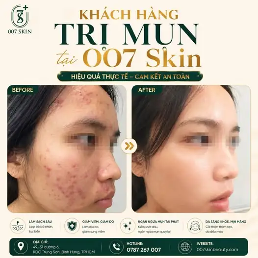 THAY ĐỔI LÀN DA - ĐỔI THAY CUỘC SỐNG ✨
