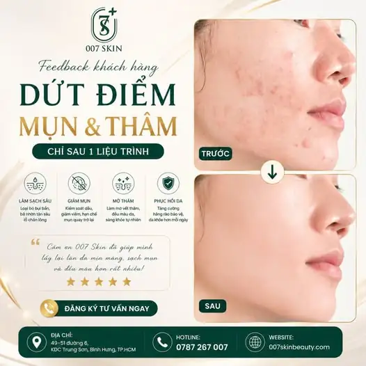 TIẾC GÌ 3 GIÂY XEM LÀN DA "LỘT XÁC" THẦN KÌ TẠI 007 SKIN! ✨