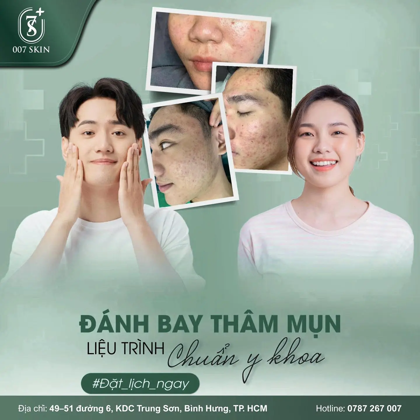 TỰ TIN TỪNG NGÀY – ĐÁNH BAY THÂM MỤN VỚI LIỆU TRÌNH CHUẨN Y KHOA