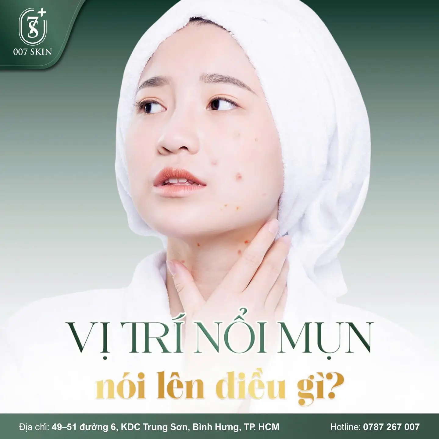 VỊ TRÍ NỔI MỤN NÓI GÌ VỀ SỨC KHỎE CỦA BẠN?