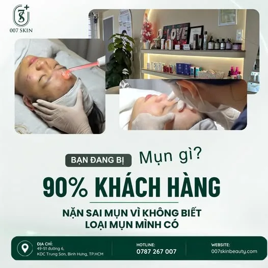 🌿 BẠN ĐANG BỊ MỤN GÌ? ĐỪNG NẶN MỤN KHI CHƯA HIỂU RÕ!