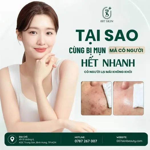 TẠI SAO CÓ NGƯỜI TRỊ MỤN NHANH, CÓ NGƯỜI LẠI MÃI KHÔNG KHỎI? 🤔